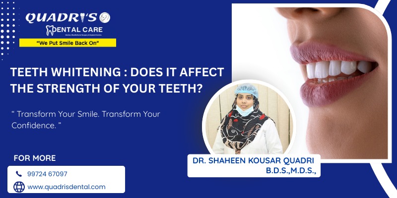 Teeth whitening in Shimoga