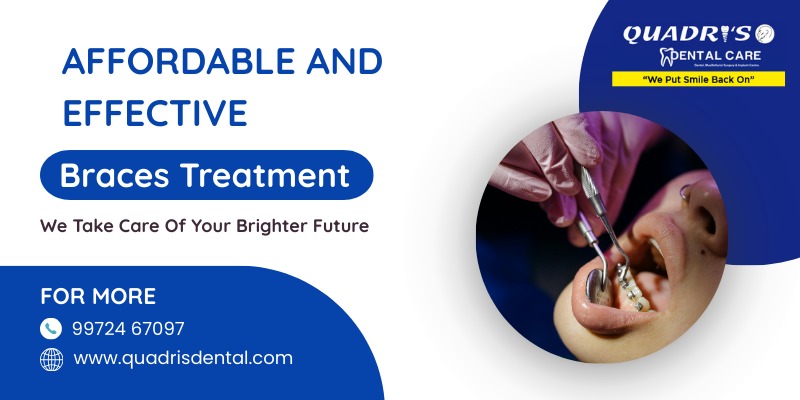 Affordable Braces Treatment in Shimoga