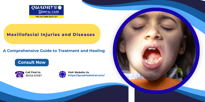 maxillofacial injuries